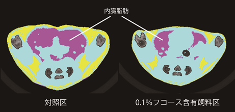 フコース摂取後腹部CT